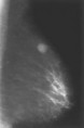 /album/zanimatelnoe-foto/fibroadenoma-2-jpg/